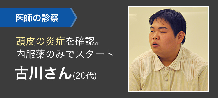 頭皮の炎症を確認。内服薬のみでスタート 古川さん(20代)