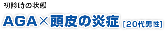 初診時の状態 AGA×頭皮の炎症 (20代男性)