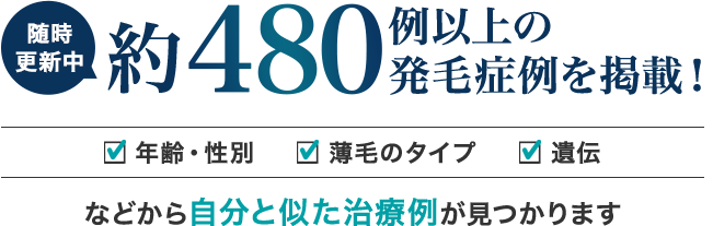 随時更新中 約480例以上の発毛症例を掲載！