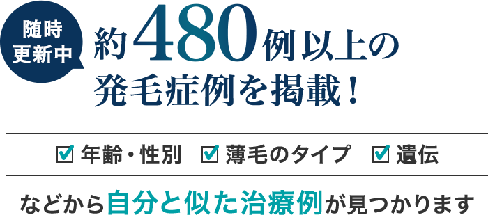 随時更新中 約480例以上の発毛症例を掲載！