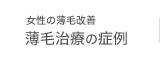女性の薄毛改善　薄毛治療の症例