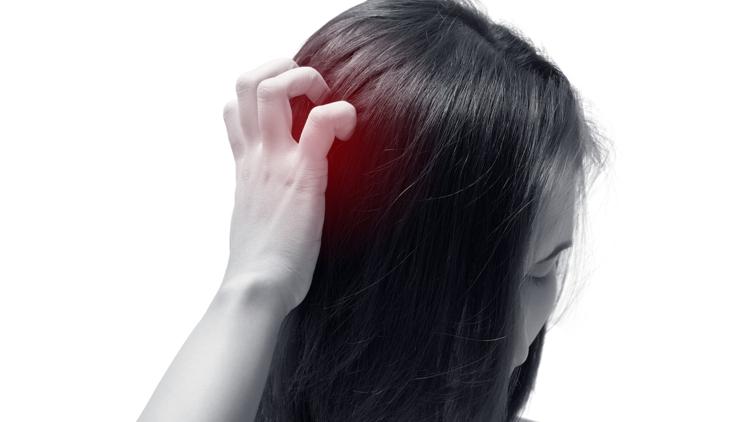 痛い頭皮ニキビの原因とハゲる理由 シャンプーと薬でケアする方法 ヘアメディカル
