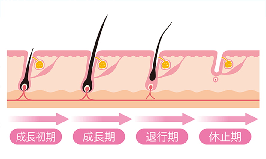 抜け毛を毛根から解析 根本に白い塊のついた毛と黒い毛は危険信号 ヘアメディカル By Dクリニック