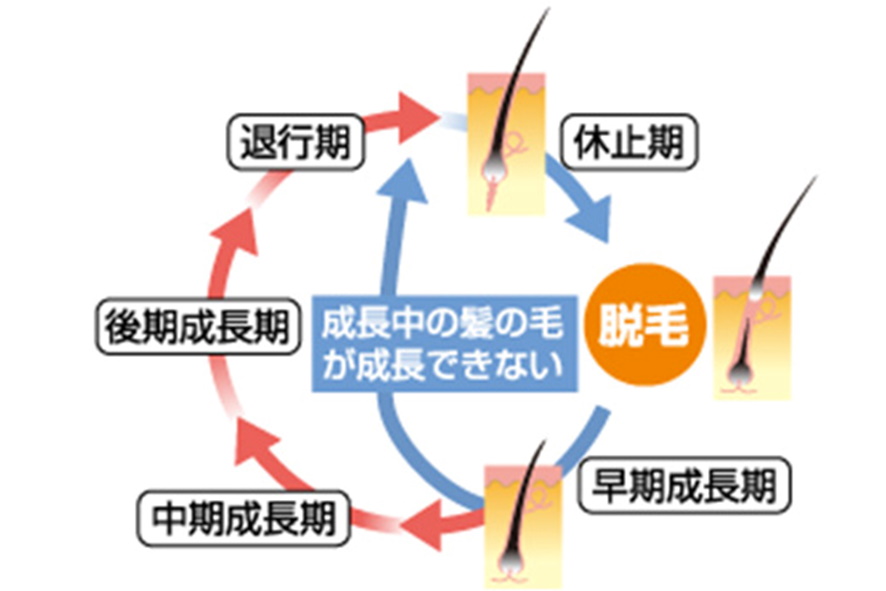 薄毛になる場合のヘアサイクル