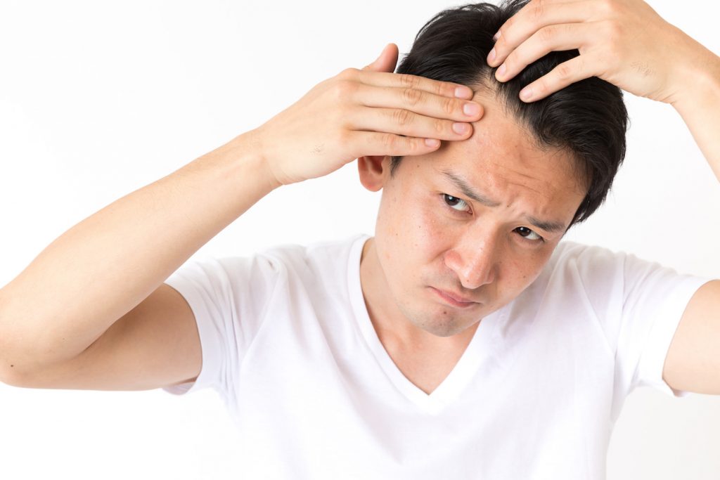 おでこの生え際が痛い！頭皮が出すシグナルは男性がハゲる前兆？｜ヘアメディカル