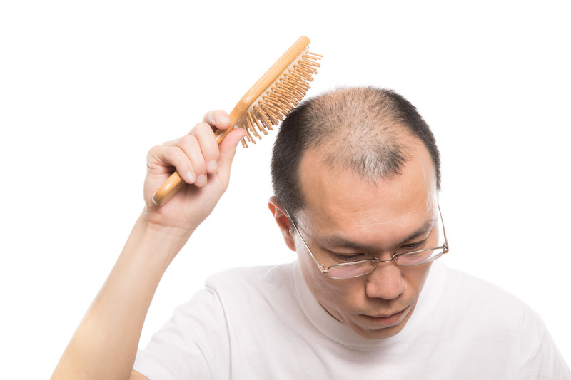 薄毛の悩み