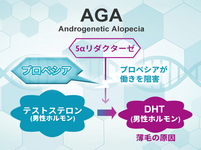 プロペシアの効力